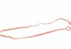 Прокладка кришки ГБЦ (к-кт) Citroen C3/C4/Peugeot VICTOR REINZ 151154901 (фото 6)